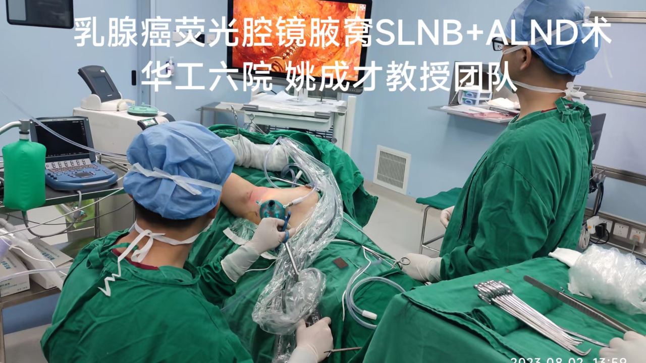 乳腺癌新輔助化療後腋窩熒光slnbalnd術手術視頻