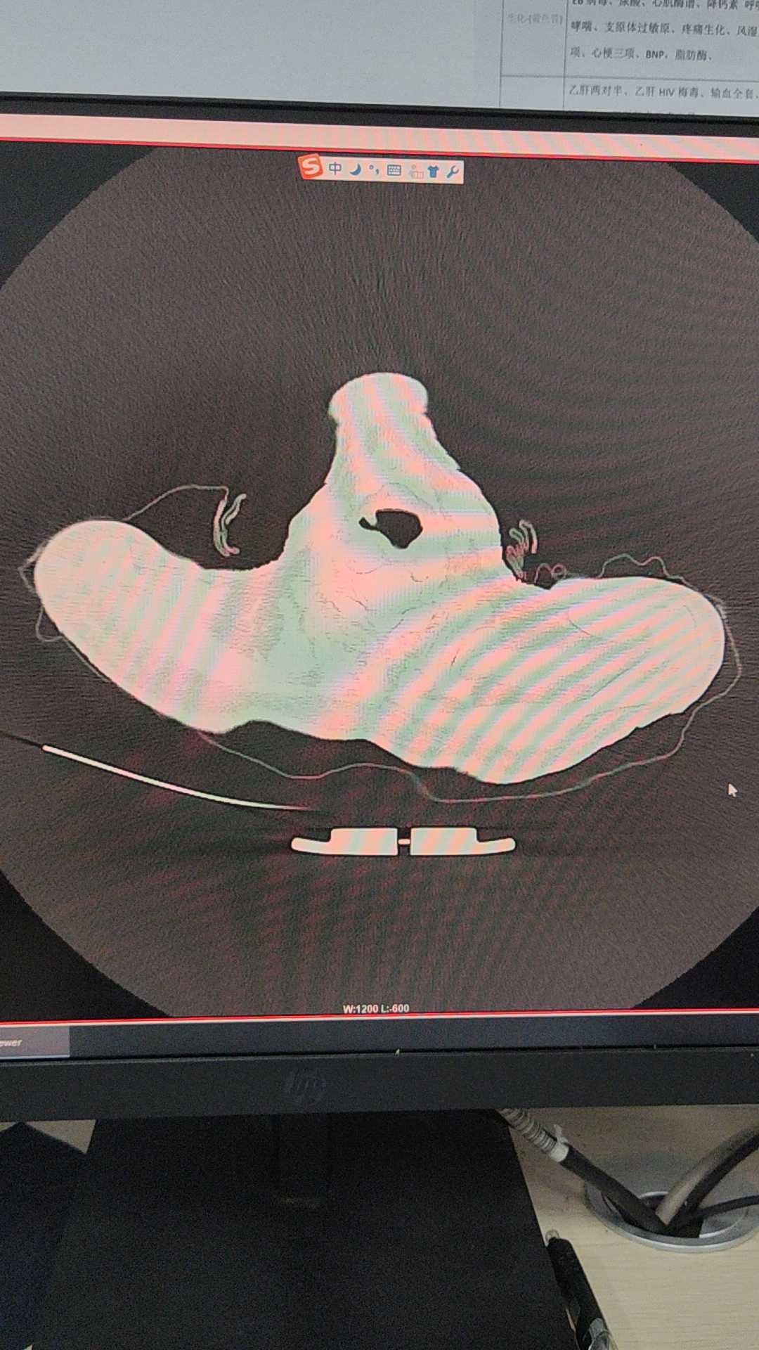 preview
