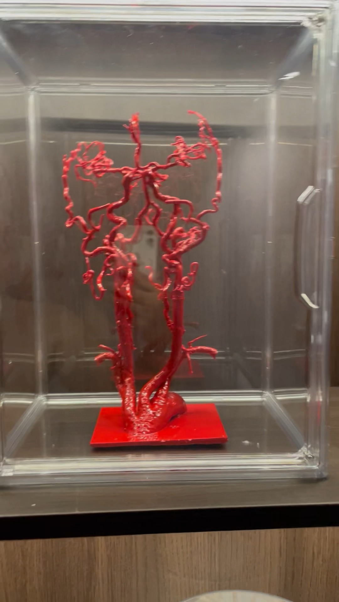 脑血管模型 基于cta数据 1:1 3d打印 完美还原