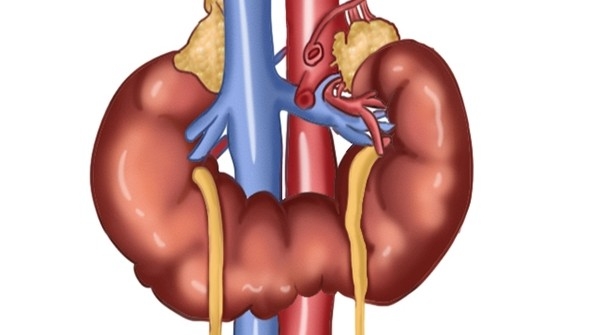 马蹄肾合并左肾肿瘤,腹腔镜下左肾部分切除术
