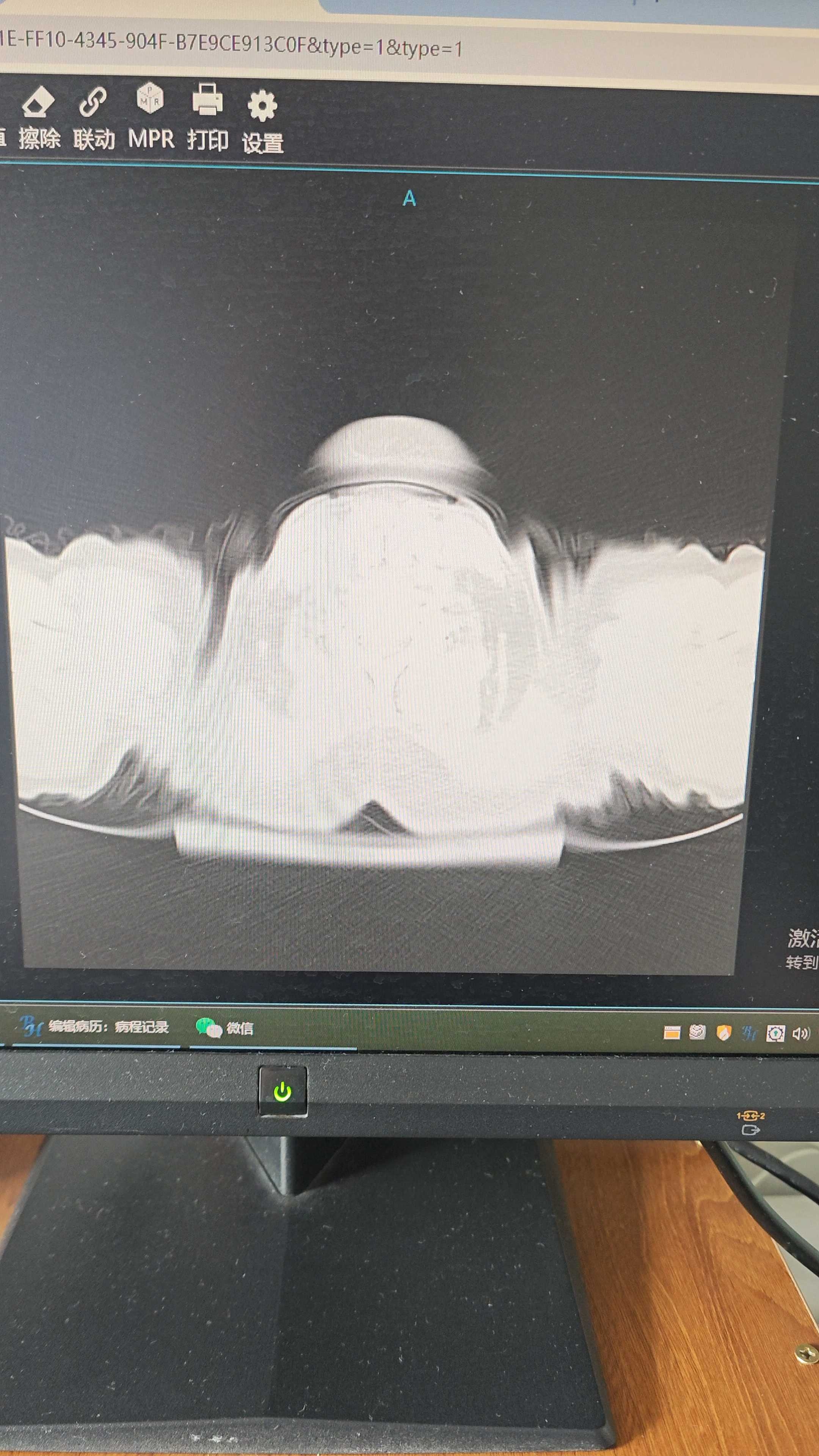 preview