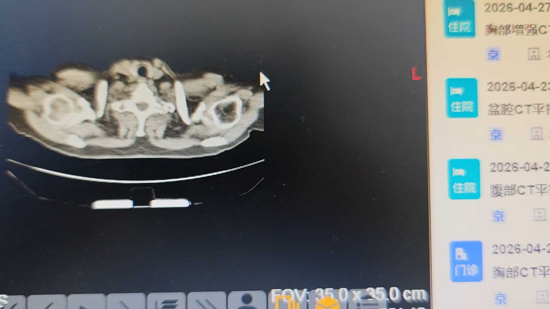 气管里是什么?