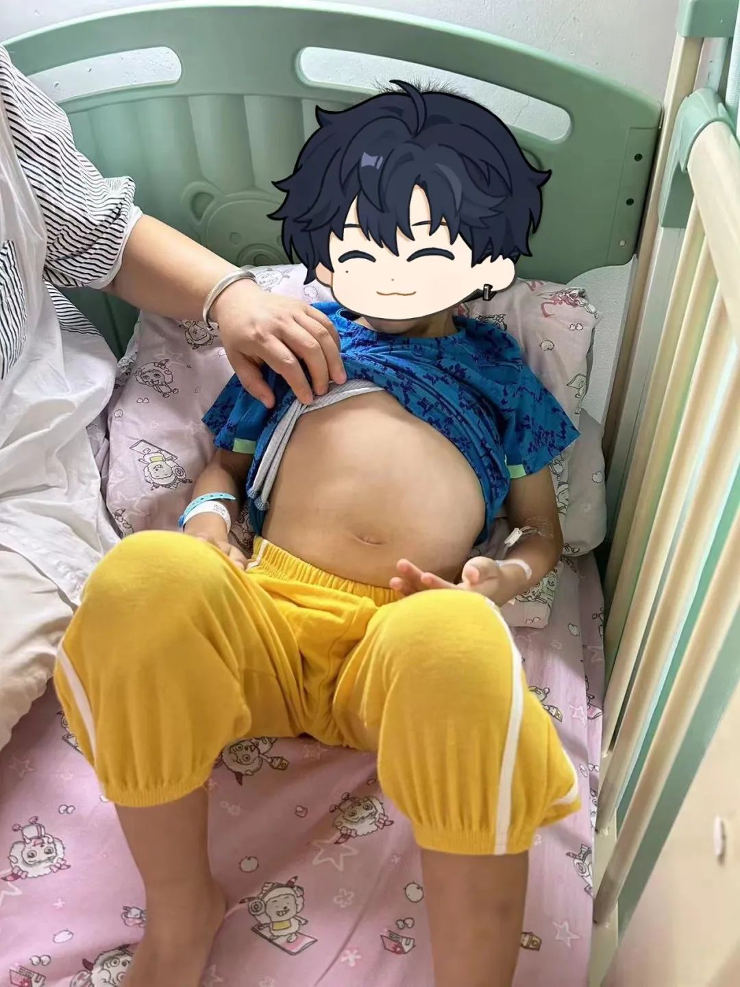 孩子腹部莫名肿胀，需警惕脾囊肿！
