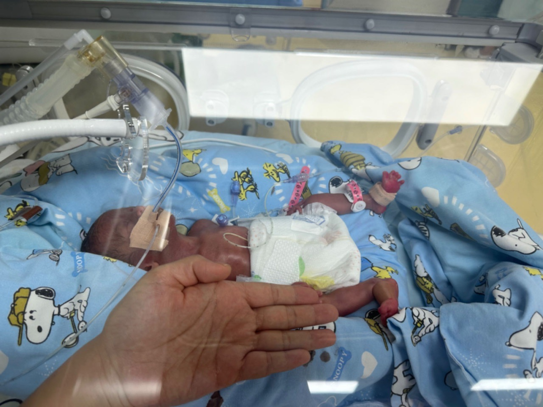 巴掌婴儿 55 天苦难之旅， 佛山市三水区人民医院高质量救治新模式保驾护航