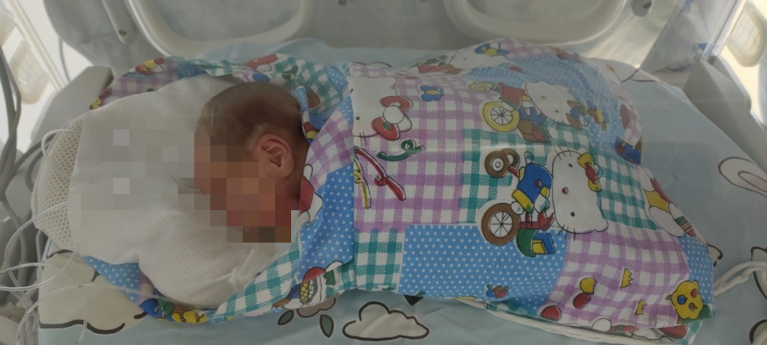 巴掌婴儿 55 天苦难之旅， 佛山市三水区人民医院高质量救治新模式保驾护航