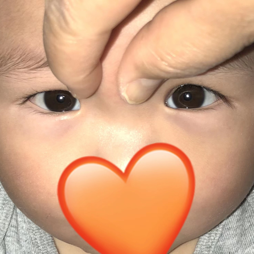 宝宝『歪头斜眼』别大意，可能是这种眼部疾病，要尽早治疗