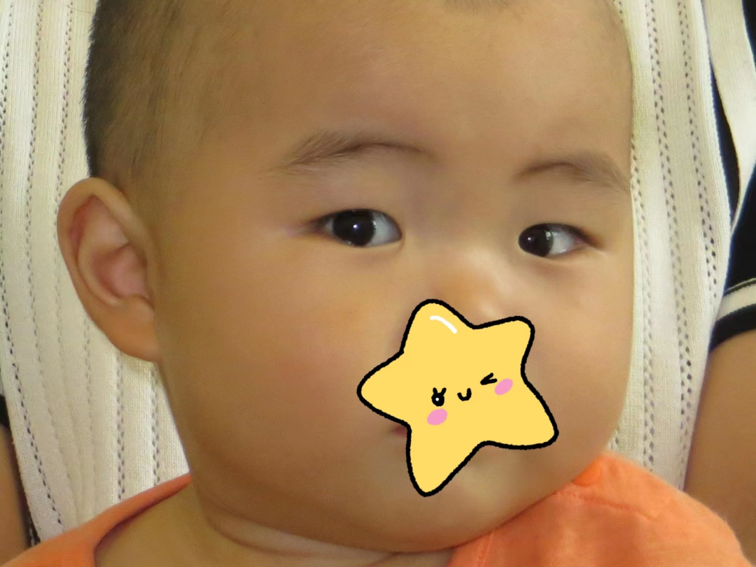 宝宝『歪头斜眼』别大意，可能是这种眼部疾病，要尽早治疗