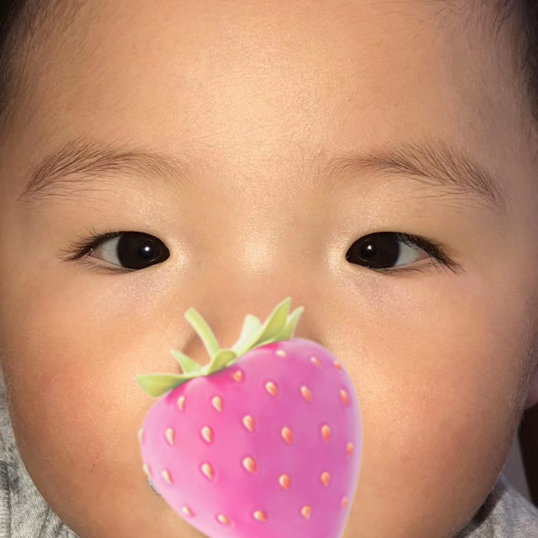 宝宝『歪头斜眼』别大意，可能是这种眼部疾病，要尽早治疗