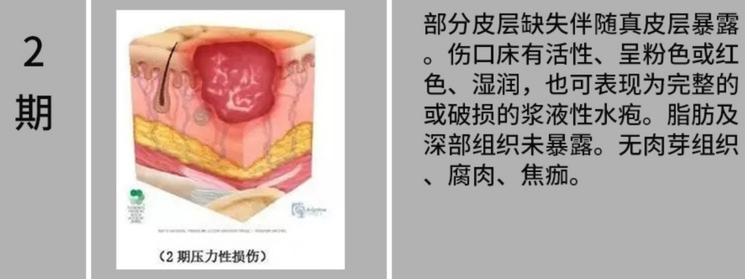 「躺平」也有风险,5 招帮你远离这个要命的「压力」