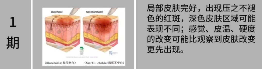 「躺平」也有风险,5 招帮你远离这个要命的「压力」