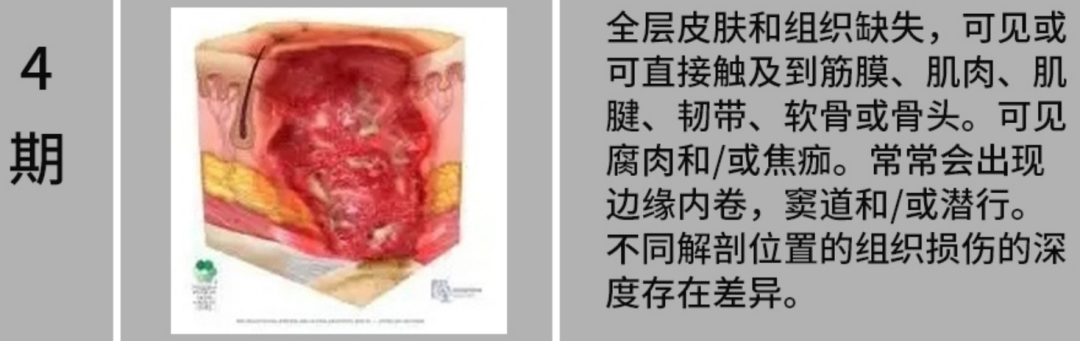 「躺平」也有风险,5 招帮你远离这个要命的「压力」