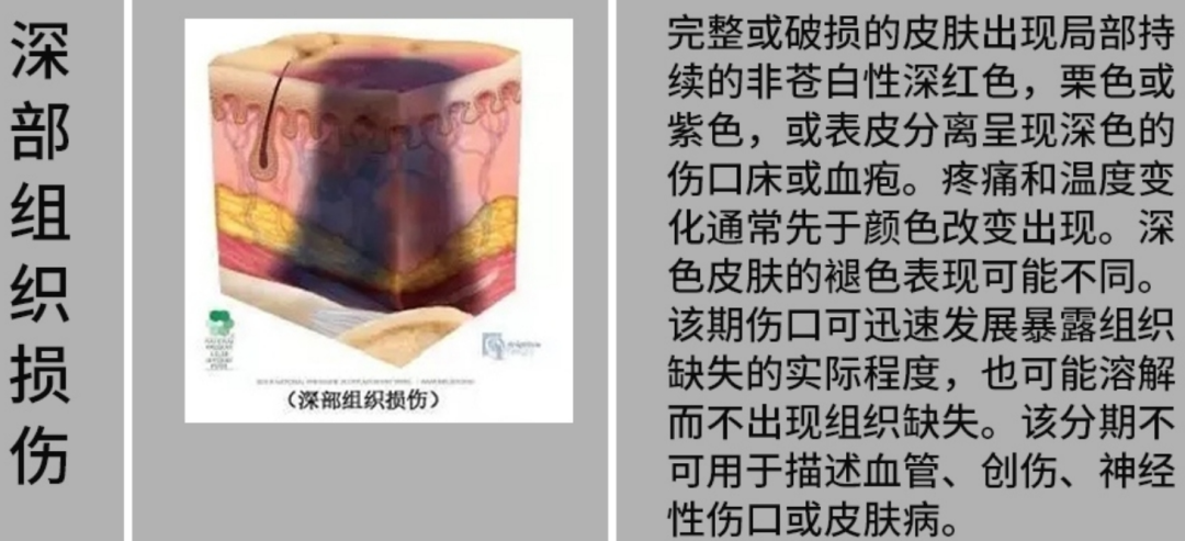 「躺平」也有风险,5 招帮你远离这个要命的「压力」