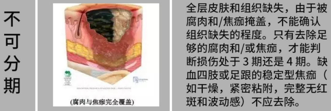 「躺平」也有风险,5 招帮你远离这个要命的「压力」