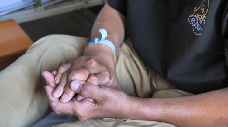 每天两瓶可乐，年轻男子患上骨质疏松症
