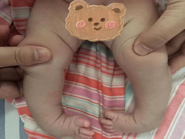 拖不起！肚子里受挤压，宝宝出生后这些部位都『变形』了！