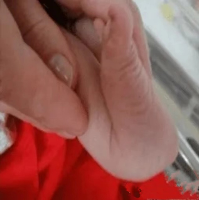 拖不起！肚子里受挤压，宝宝出生后这些部位都『变形』了！