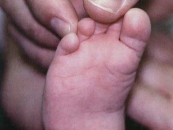 拖不起！肚子里受挤压，宝宝出生后这些部位都『变形』了！