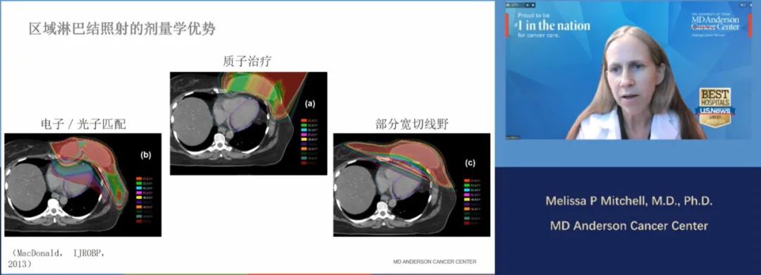 学术研讨：乳腺癌最新防治新进展
