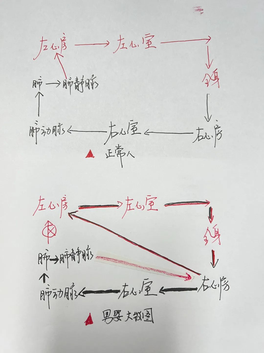 高难度心脏手术,让 9 日龄男婴错位心脏血液循环恢复正常