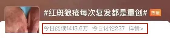 关于红斑狼疮，这些知识一定要知道！
