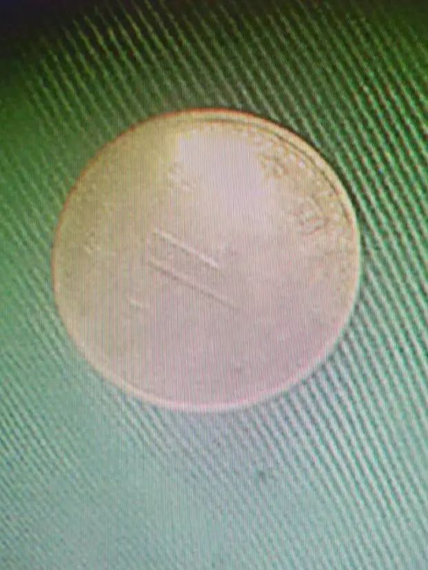 误吞订书针,扎进胃里!电池、硬币、铜葫芦... 医生从身体里都取出过啥