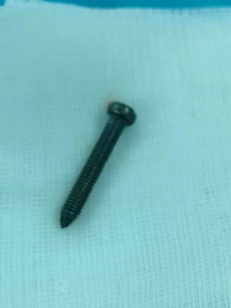 误吞订书针,扎进胃里!电池、硬币、铜葫芦... 医生从身体里都取出过啥