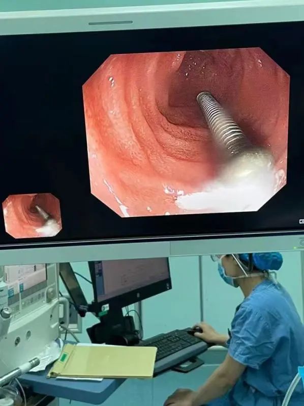 误吞订书针,扎进胃里!电池、硬币、铜葫芦... 医生从身体里都取出过啥