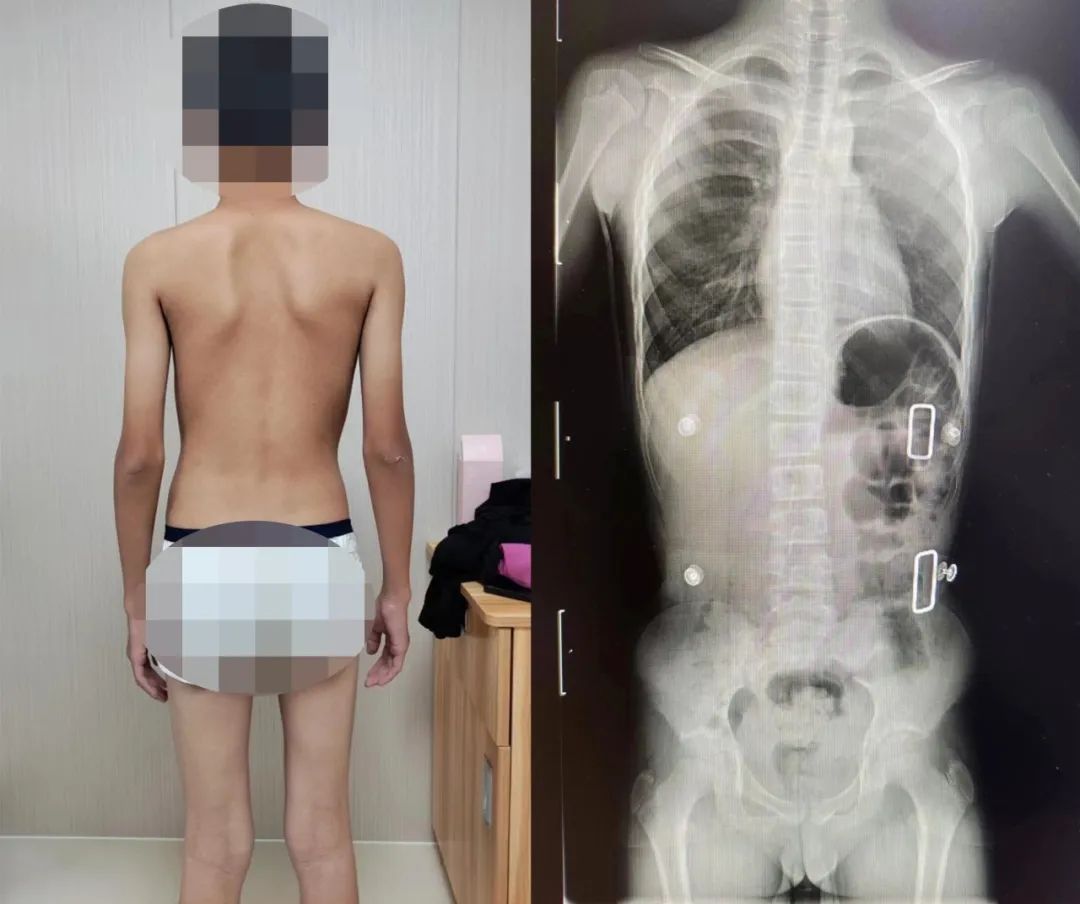 崩溃！你家小孩做作业时会不会歪来扭去？