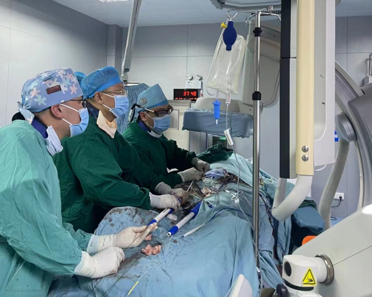 腹主动脉瘤破裂危在旦夕!南溪山医院血管外科精准「拆弹」力挽狂澜