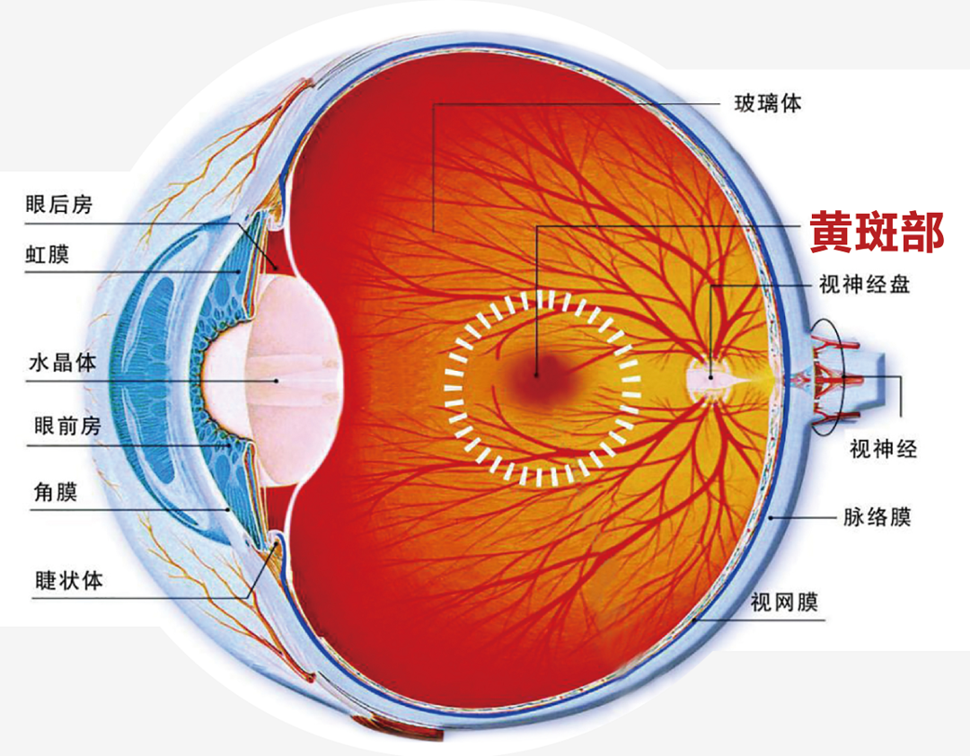 「老花」与黄斑前膜早期相似，但后果可大不一样！