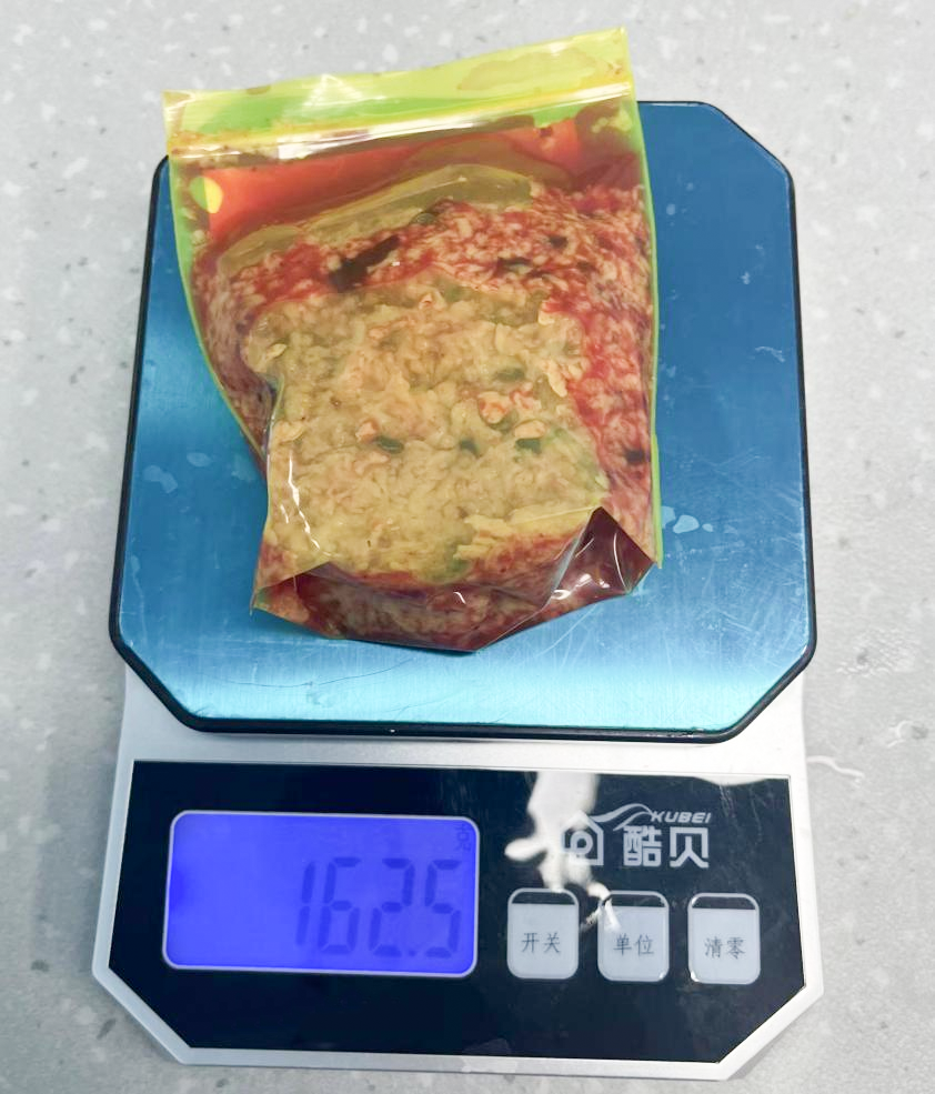 延安市中医医院泌尿外科完成一例巨大体积前列腺钬激光剜除＋组织粉碎手术