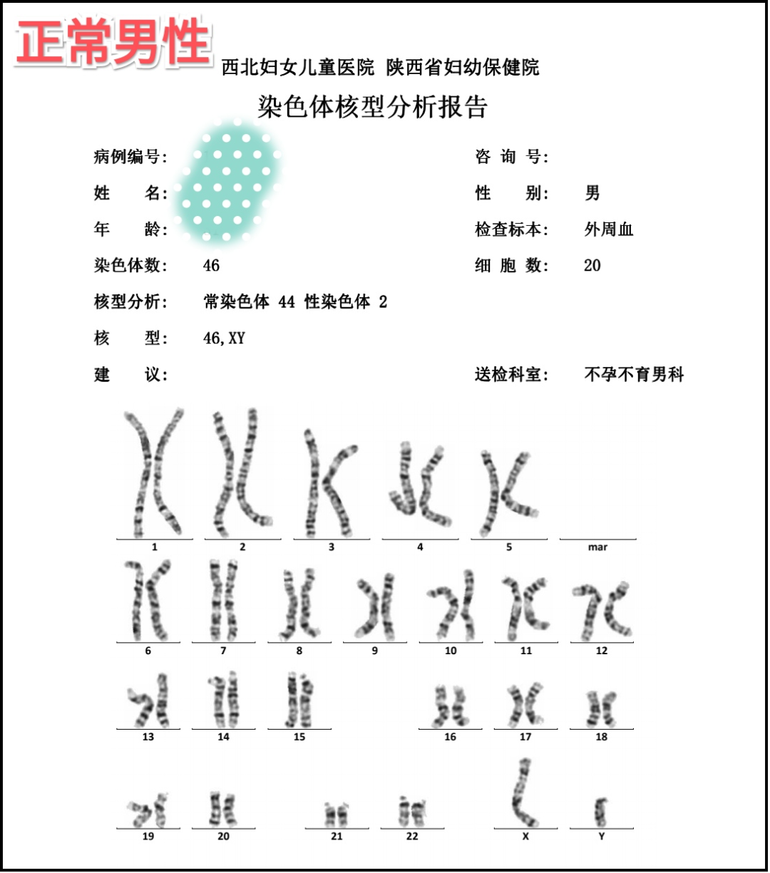 得这种病，男性又高又帅，却没有精子