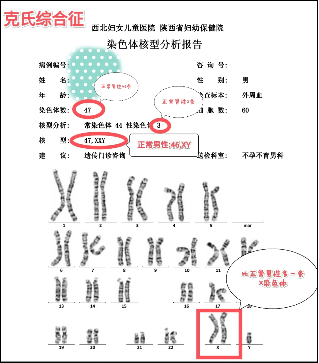 得这种病，男性又高又帅，却没有精子