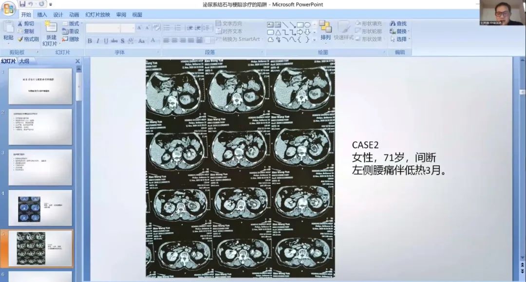 前沿引领 展望未来 — 2023 苏州明基医院第四届海峡两岸姑苏泌尿微创论坛成功举办