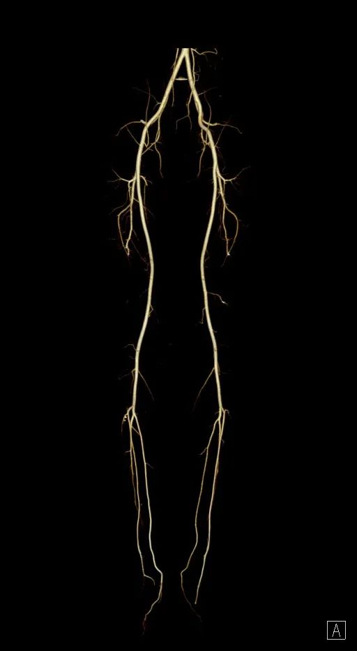 延安市中医医院影像中心加入陕西省心血管影像专科联盟，为患者提供更加优质、专业的医学影像诊疗服务