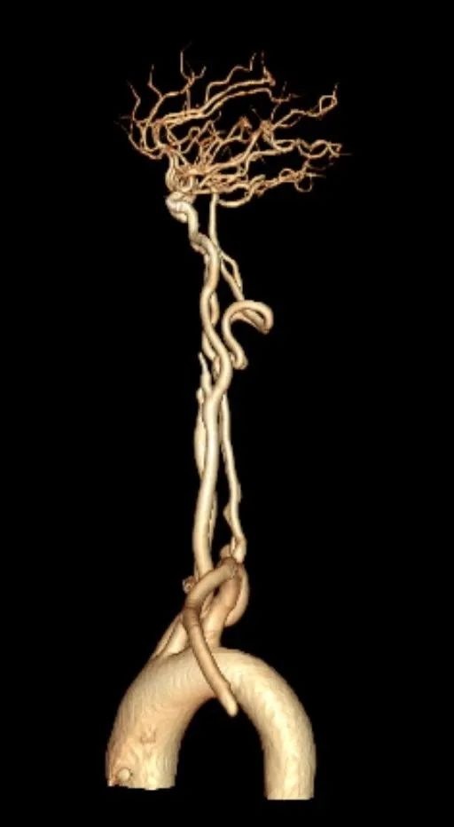 延安市中医医院影像中心加入陕西省心血管影像专科联盟，为患者提供更加优质、专业的医学影像诊疗服务