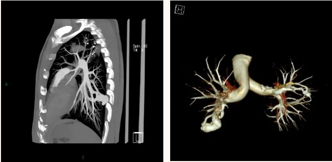 延安市中医医院影像中心加入陕西省心血管影像专科联盟，为患者提供更加优质、专业的医学影像诊疗服务