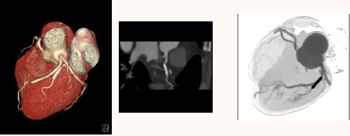 延安市中医医院影像中心加入陕西省心血管影像专科联盟，为患者提供更加优质、专业的医学影像诊疗服务