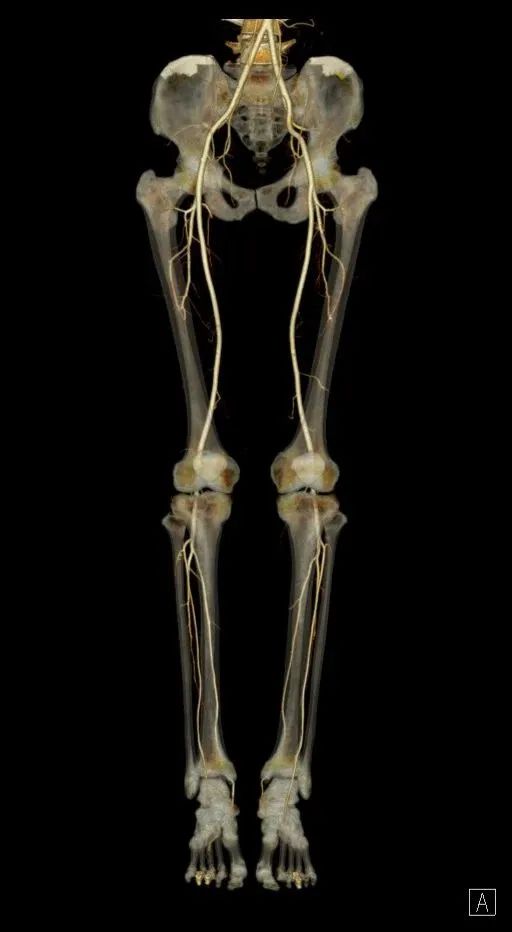 延安市中医医院影像中心加入陕西省心血管影像专科联盟，为患者提供更加优质、专业的医学影像诊疗服务