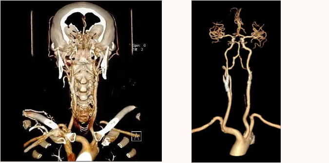 延安市中医医院影像中心加入陕西省心血管影像专科联盟，为患者提供更加优质、专业的医学影像诊疗服务