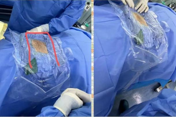 走进延安市中医医院手术室，了解不一样的温柔天使