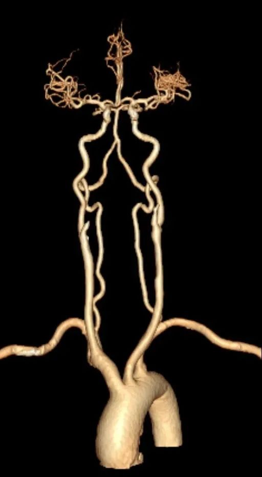 延安市中医医院影像中心加入陕西省心血管影像专科联盟，为患者提供更加优质、专业的医学影像诊疗服务