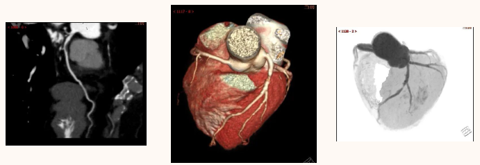 延安市中医医院影像中心加入陕西省心血管影像专科联盟，为患者提供更加优质、专业的医学影像诊疗服务