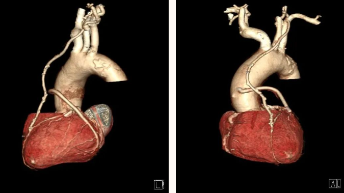 延安市中医医院影像中心加入陕西省心血管影像专科联盟，为患者提供更加优质、专业的医学影像诊疗服务