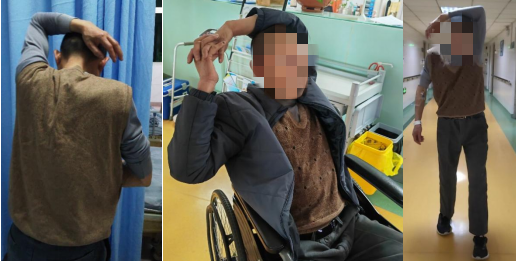 臂痛导致不能放手也难以入睡，小心惹上神经根型颈椎病