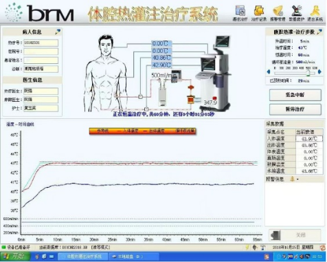 国内首部！中山大学孙逸仙纪念医院主持完成妇科肿瘤腹腔热灌注化疗应用指南，为卵巢癌治疗提供系统方案