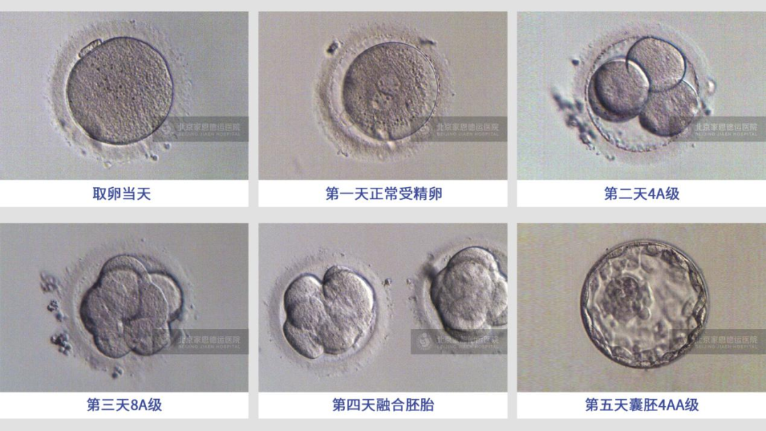 想要成功率高就要选囊胚移植？