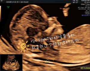 与小宝贝的第一次「亲密」接触,您准备好了吗