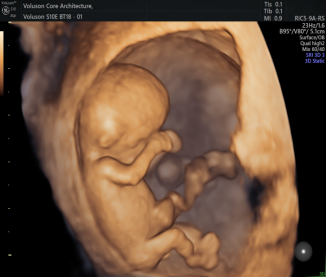 与小宝贝的第一次「亲密」接触,您准备好了吗