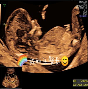 与小宝贝的第一次「亲密」接触,您准备好了吗